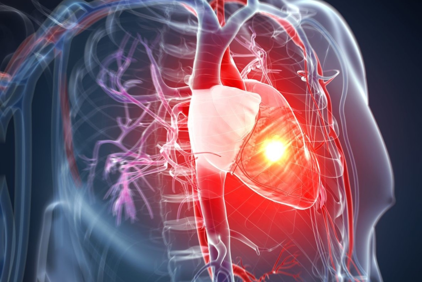 AHA/ACC Issue Updated Chronic Coronary Disease Guidelines