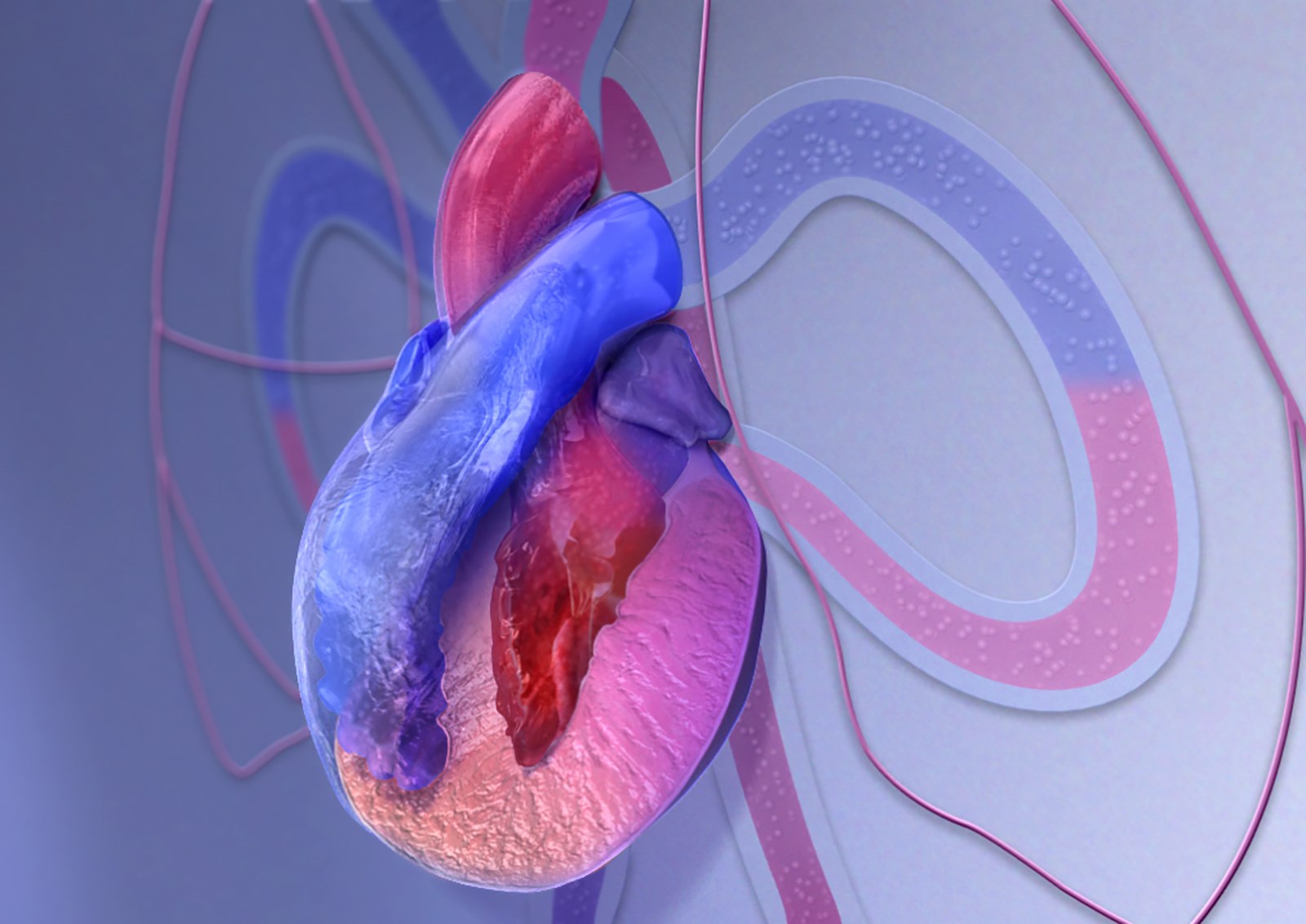 Management of arrhythmogenic right ventricular cardiomyopathy