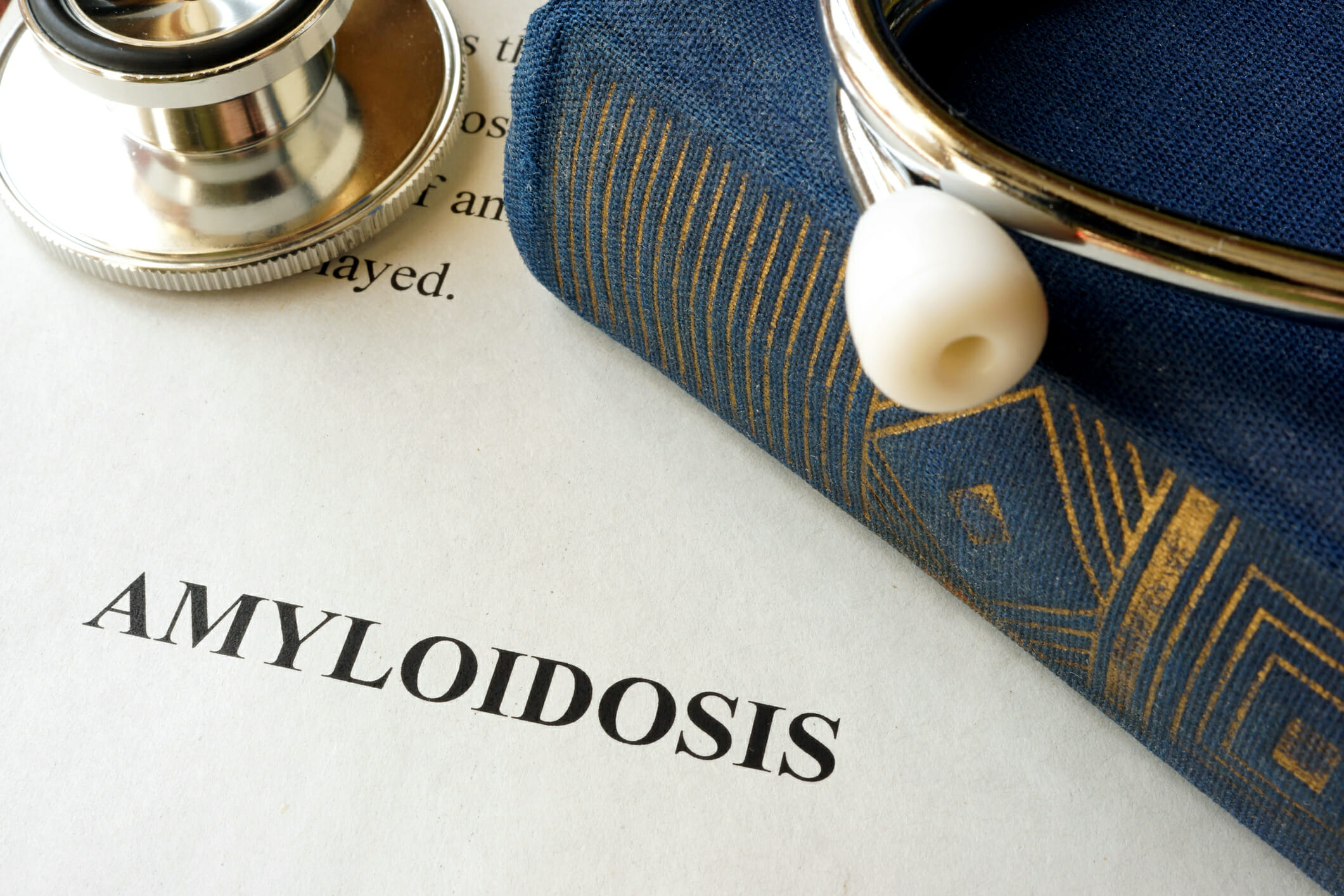 Scotland Accepts New RNAi Therapy for Cardiac Amyloidosis