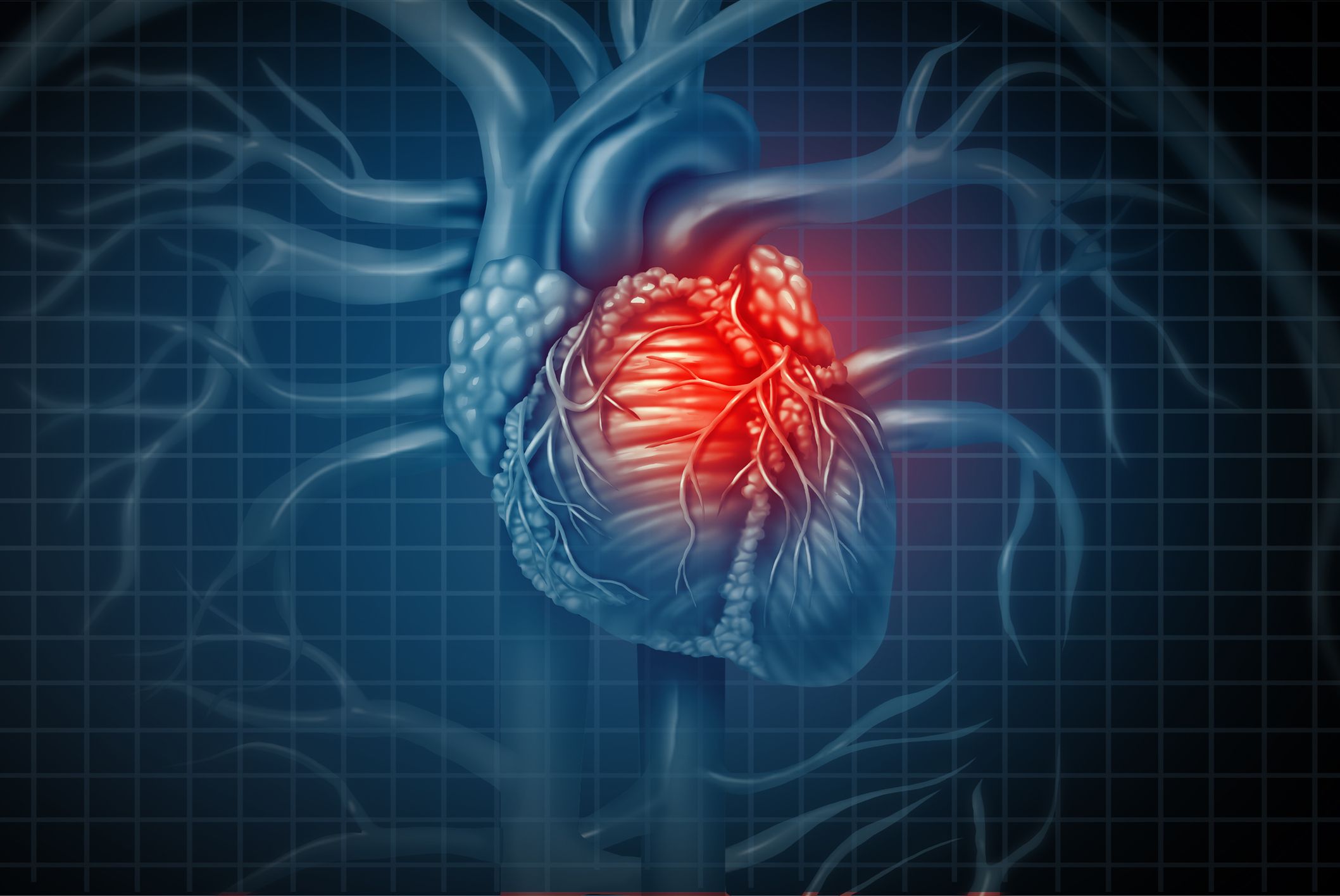 Cancer Identified as a New Cardiovascular Risk Factor