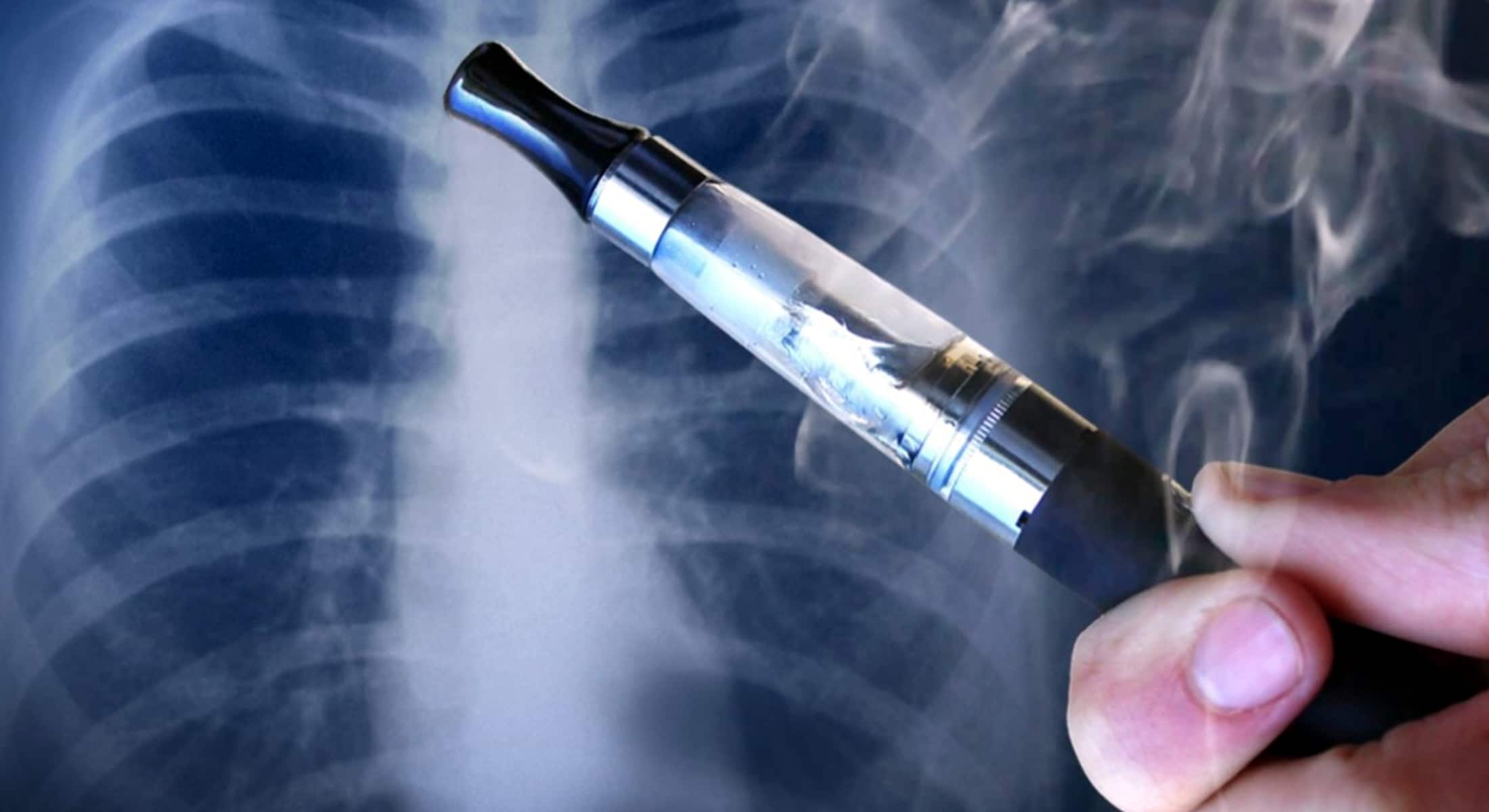 To Beat Cigarette Addiction, Experts Embrace Vapes