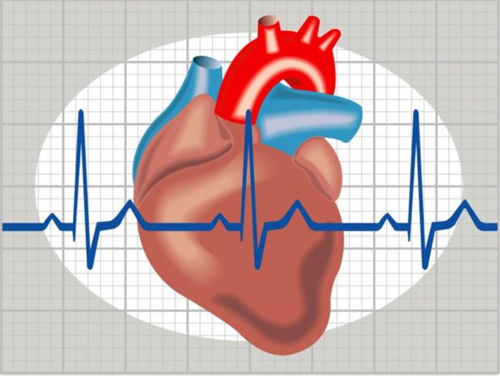 Эксперты в области кардиологии обновили рекомендации по ведению пациентов с фибрилляцией предсердий